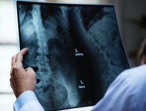 WhatsApp Image 2021 10 24 at 6.51.57 PM Spinal Cord Surgery