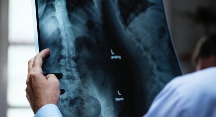 WhatsApp Image 2021 10 24 at 6.51.57 PM Spinal Cord Surgery