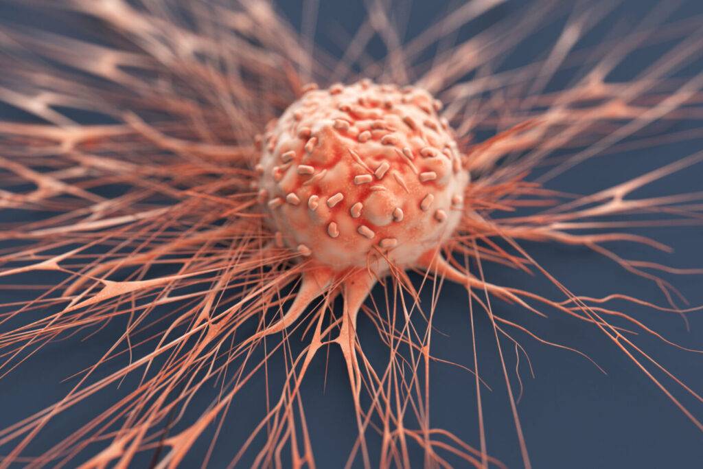 Cancer Human Cancer Cell