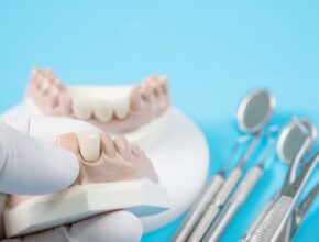 Dental Crown Dental Crown