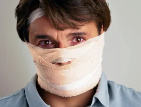 Degloved Face Degloved Face