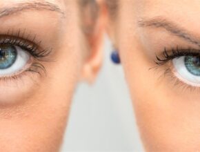 AdobeStock 172786002 1280x543 1 How to Find the Best Eyelid Surgery Near Me: Tips for Locating a Qualified Surgeon