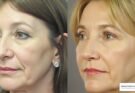 Cosmetic Surgery Prices